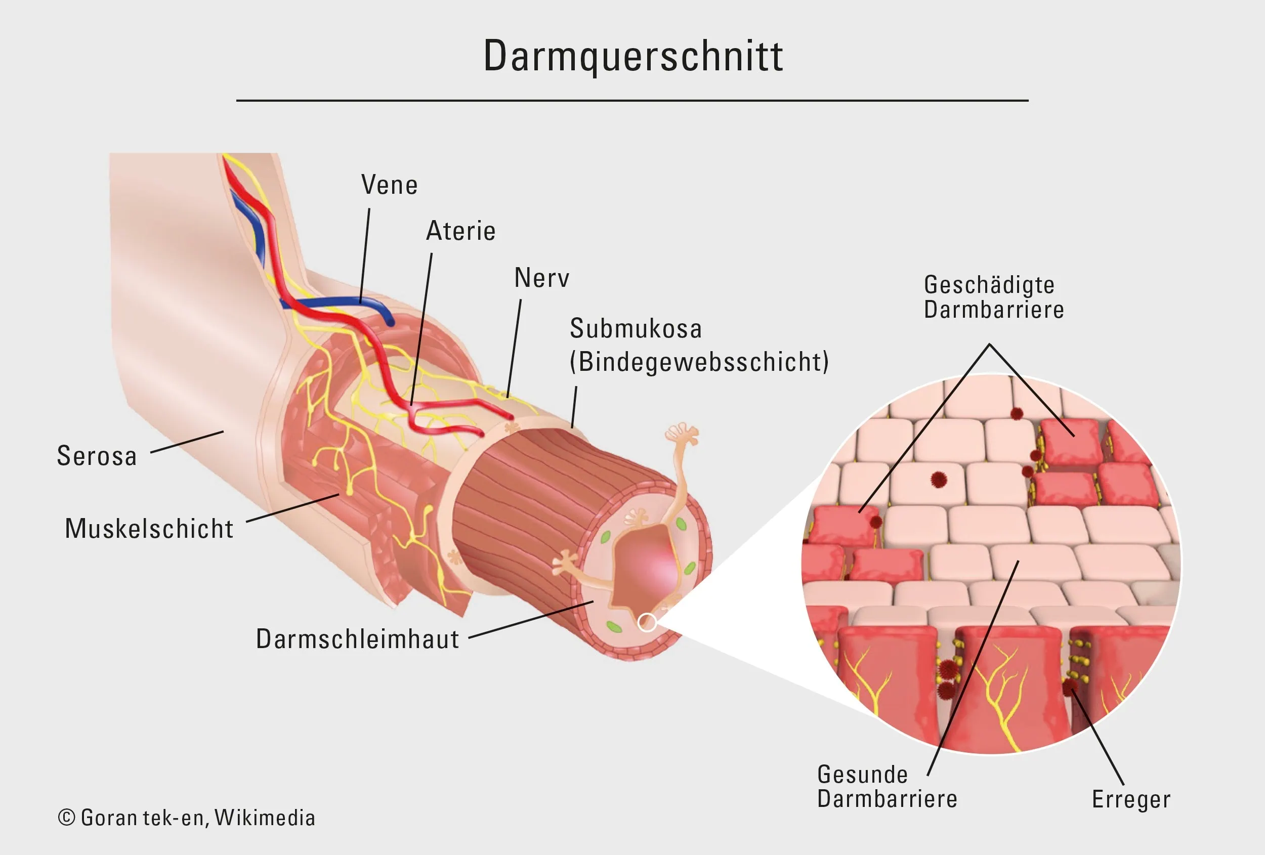 240223 Darmgrafik Ag V2 De 1 01