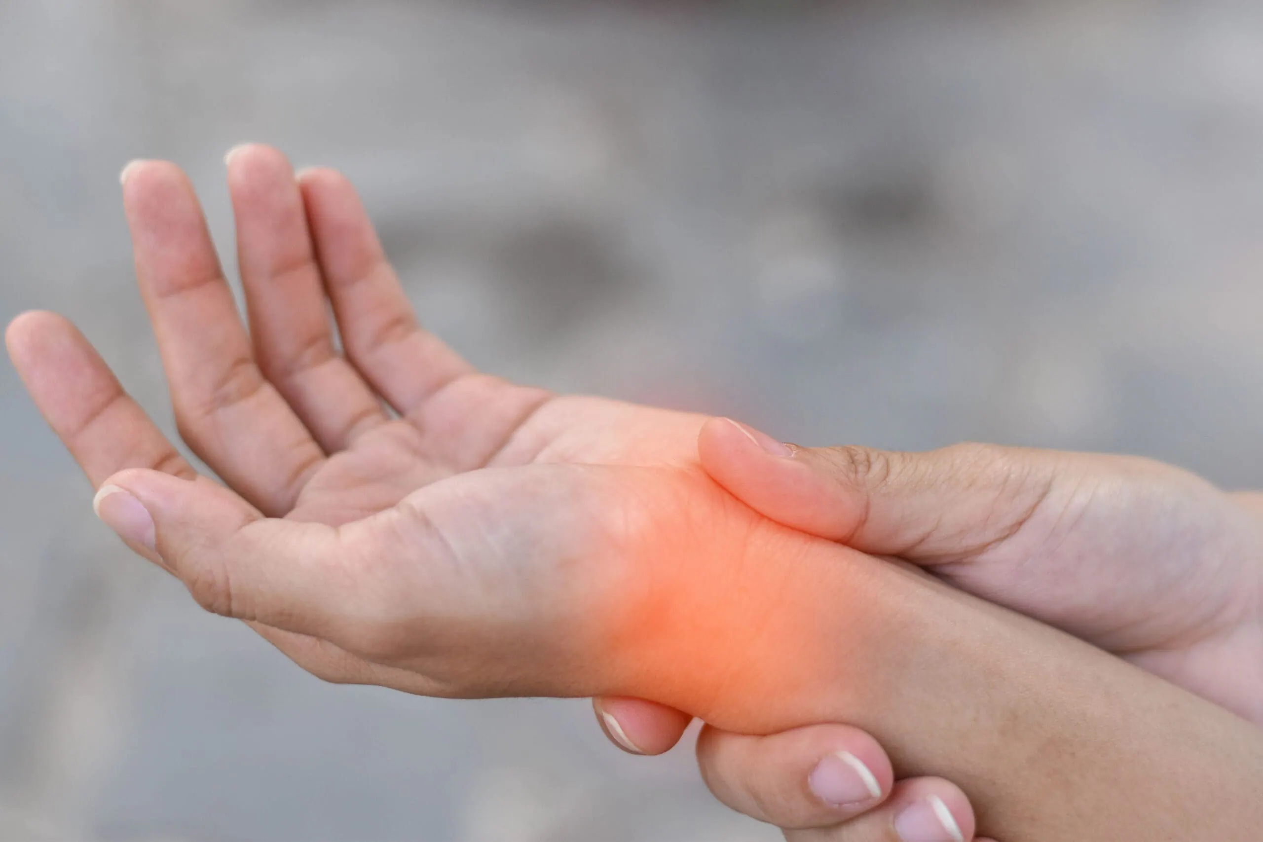 Wrist Affected By A Medical Condition, Showing Visible Signs Of Inflammation, Swelling, Or Discomfort. Pain, Injury, Or Arthritis, Carpal Tunnel Syndrome, Or Tendonitis.