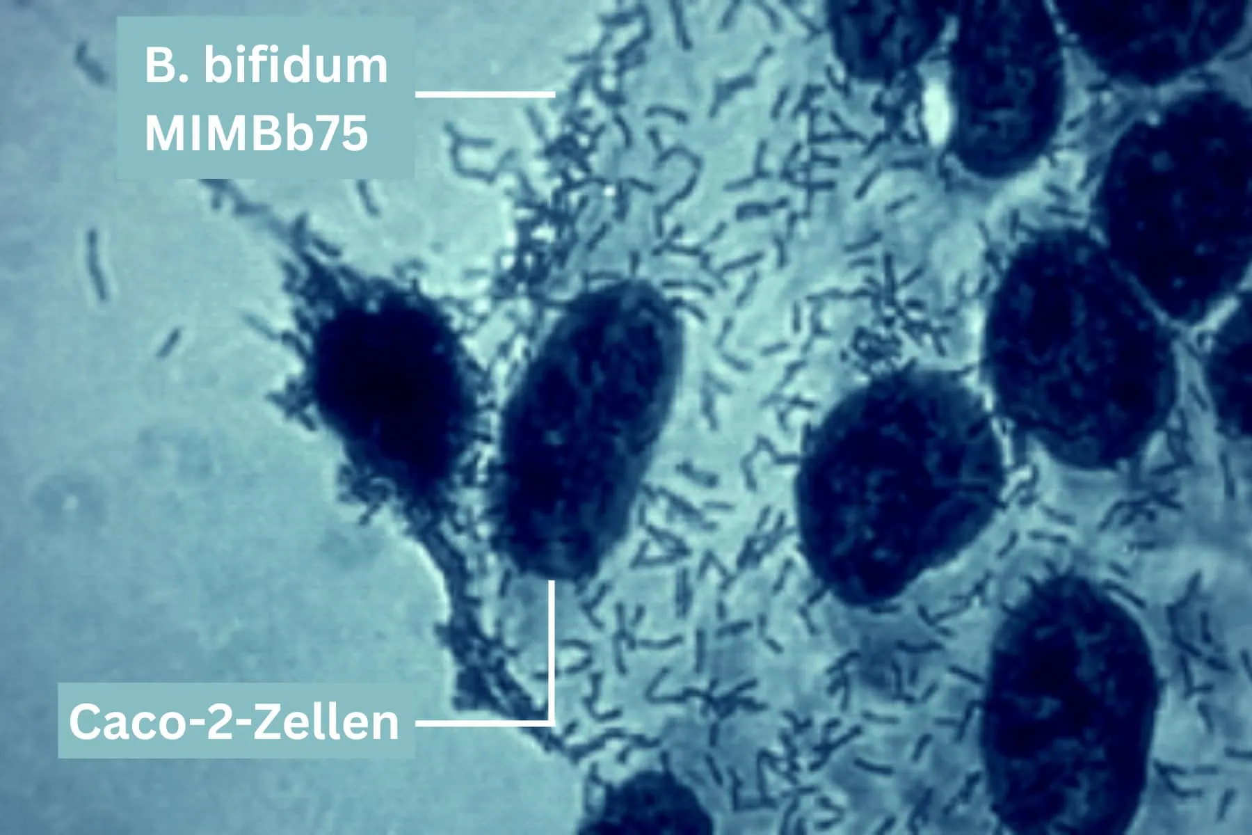 Bbifidum Mimbb75